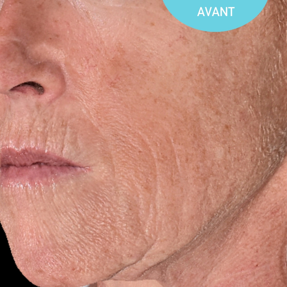 Anti-Aging Day Cream