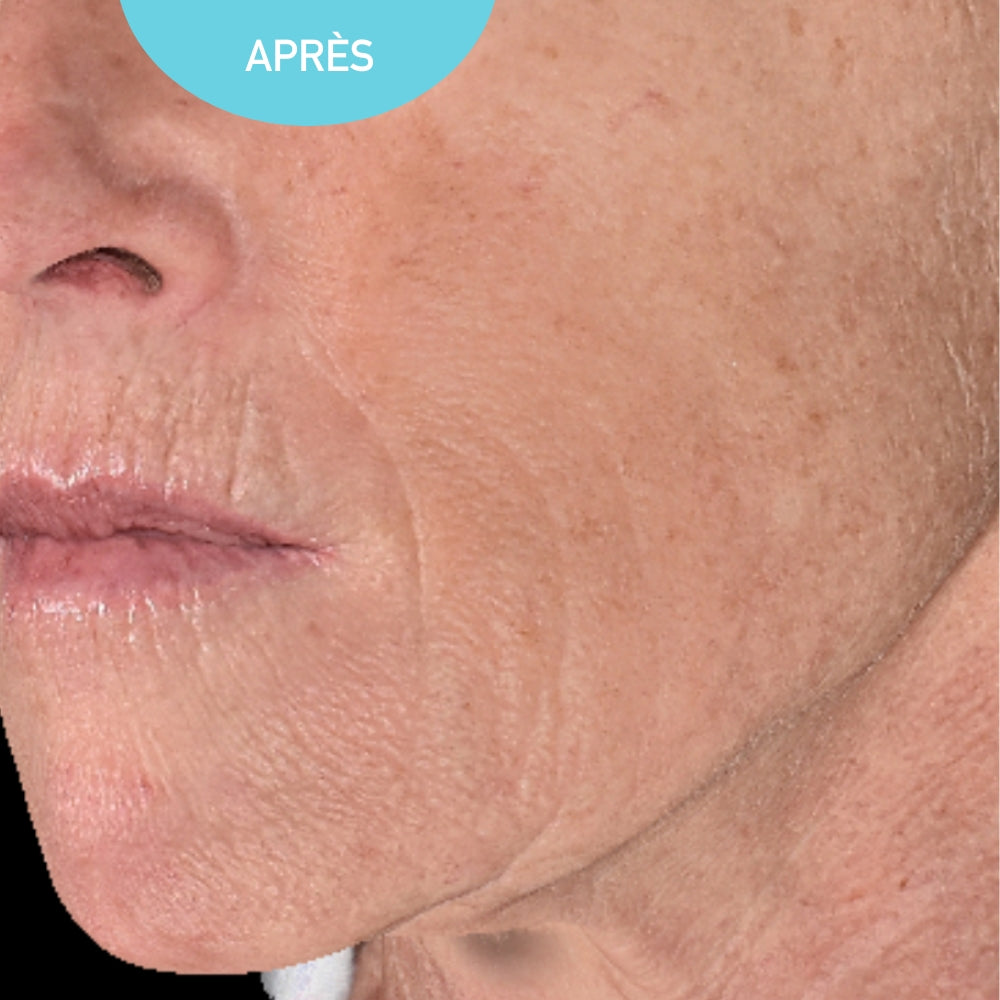 Anti-Aging Day Cream