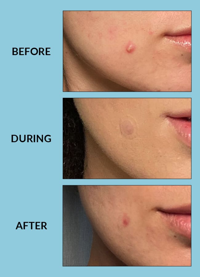 Free Skin Patches – Talika USA